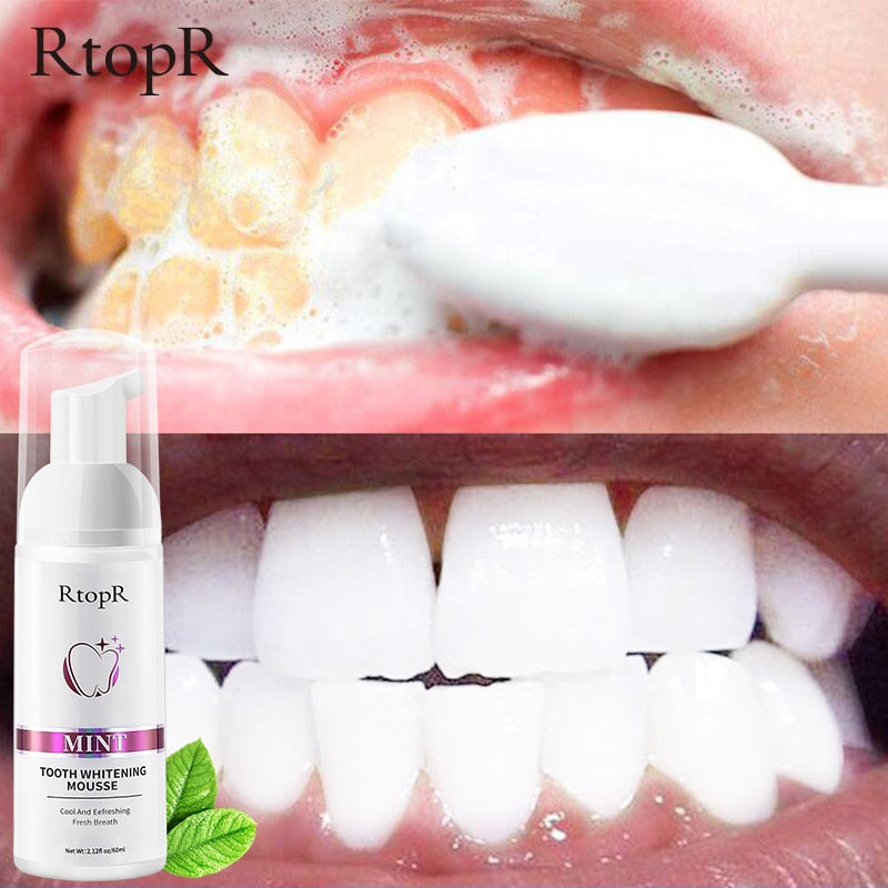 Tooth Whitening Mousse My Store