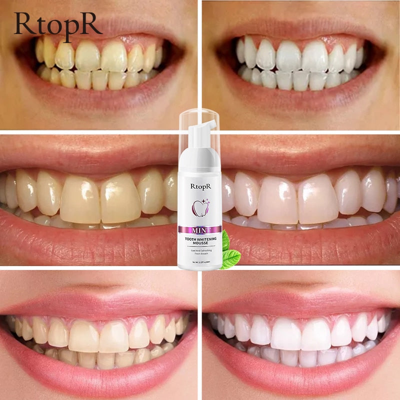 Tooth Whitening Mousse My Store