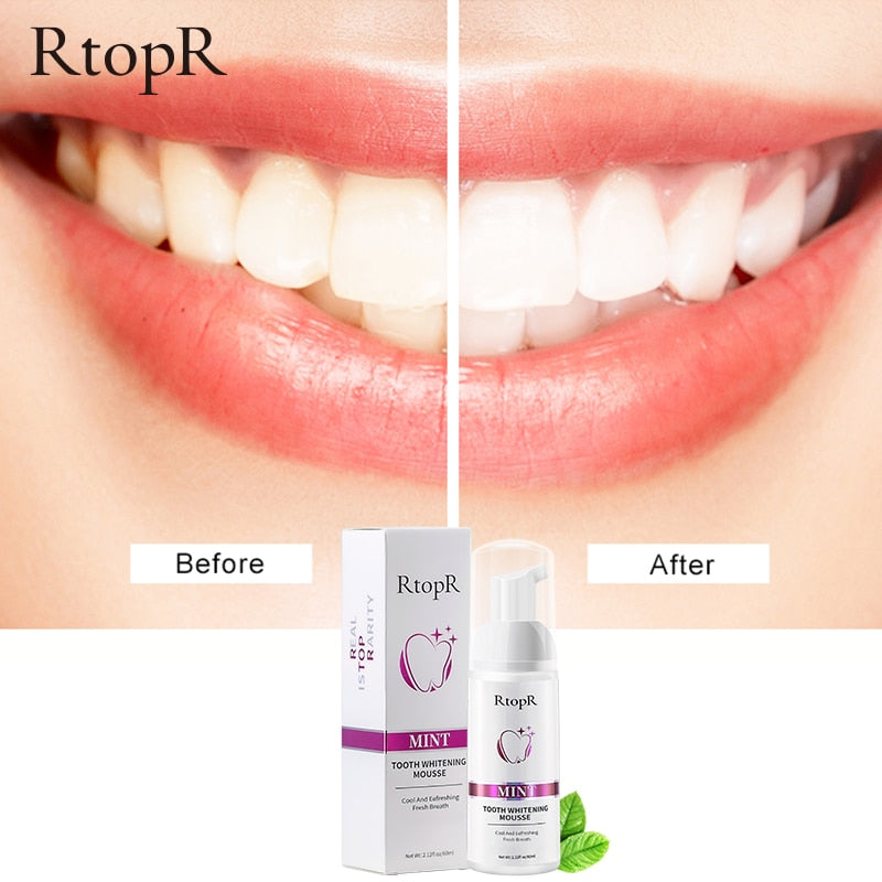 Tooth Whitening Mousse My Store
